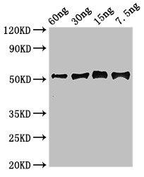 Western blot using anti-Gamma-glutamyl hydrolase antibodies